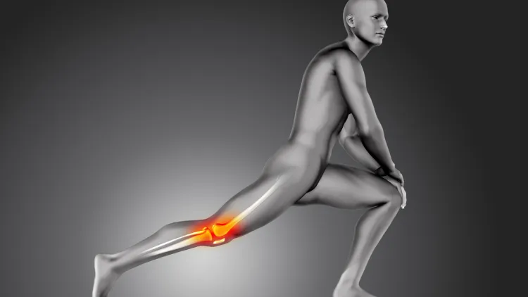 Which Bones Form the Knee Joint?
